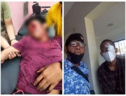 Akibat di Tusuk Pakai Kunci, Rere Andrea Kini Mata Kirinya Cacat Permanen
