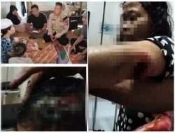 Sungguh Tega, Suami Aniaya Istri Hingga Luka Parah, Diduga Dipicu Cemburu