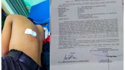 Dua Tahun Berlalu, Kasus Penganiayaan Anak di Pandeglang Mandek, LBH PAHAM Desak Polisi Tahan Pelaku