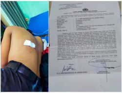 Dua Tahun Berlalu, Kasus Penganiayaan Anak di Pandeglang Mandek, LBH PAHAM Desak Polisi Tahan Pelaku